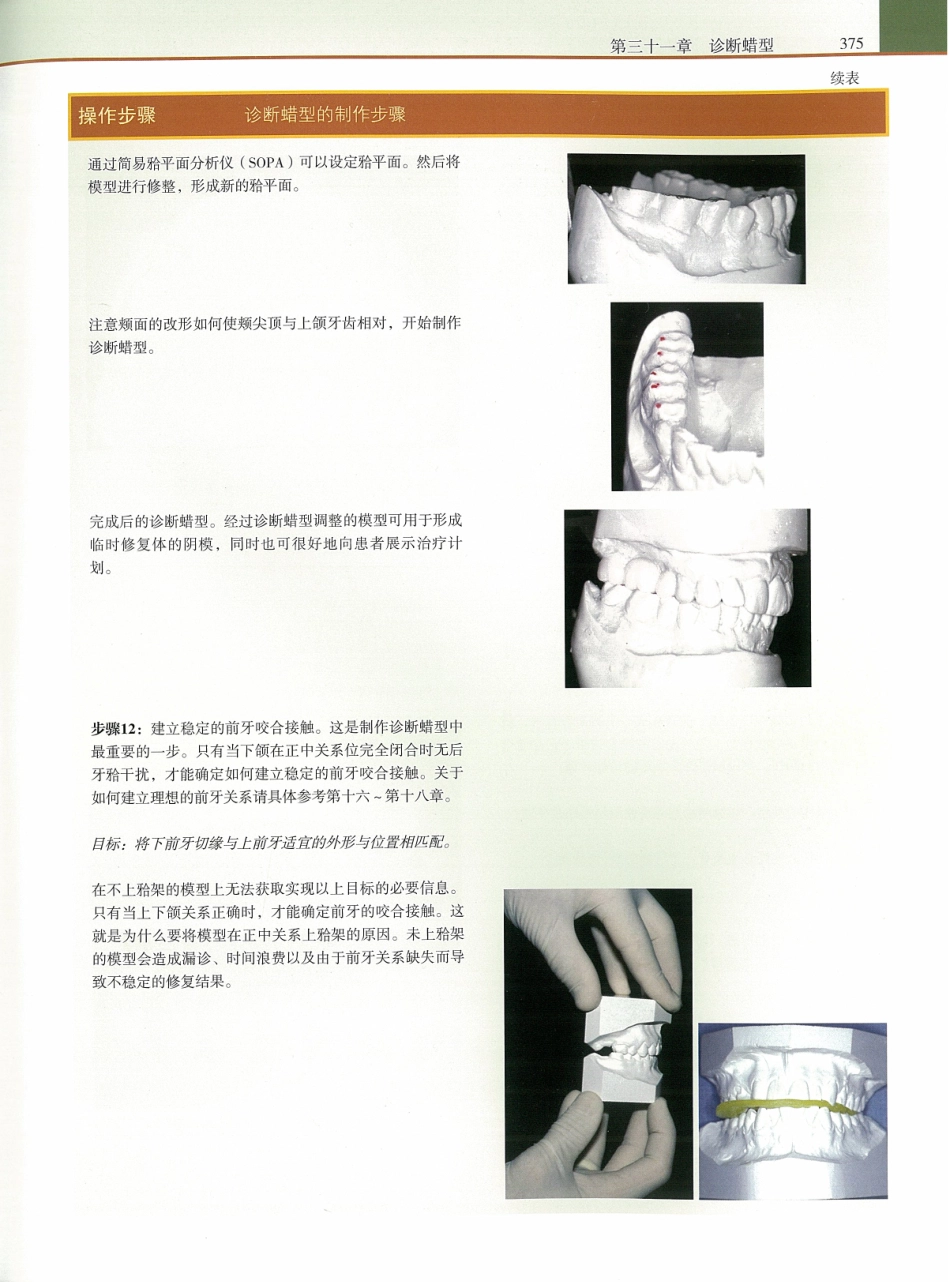 功能牙合学 从颞下颌关节到微笑设计2015年译(彩图)张豪_391-405.pdf_第3页