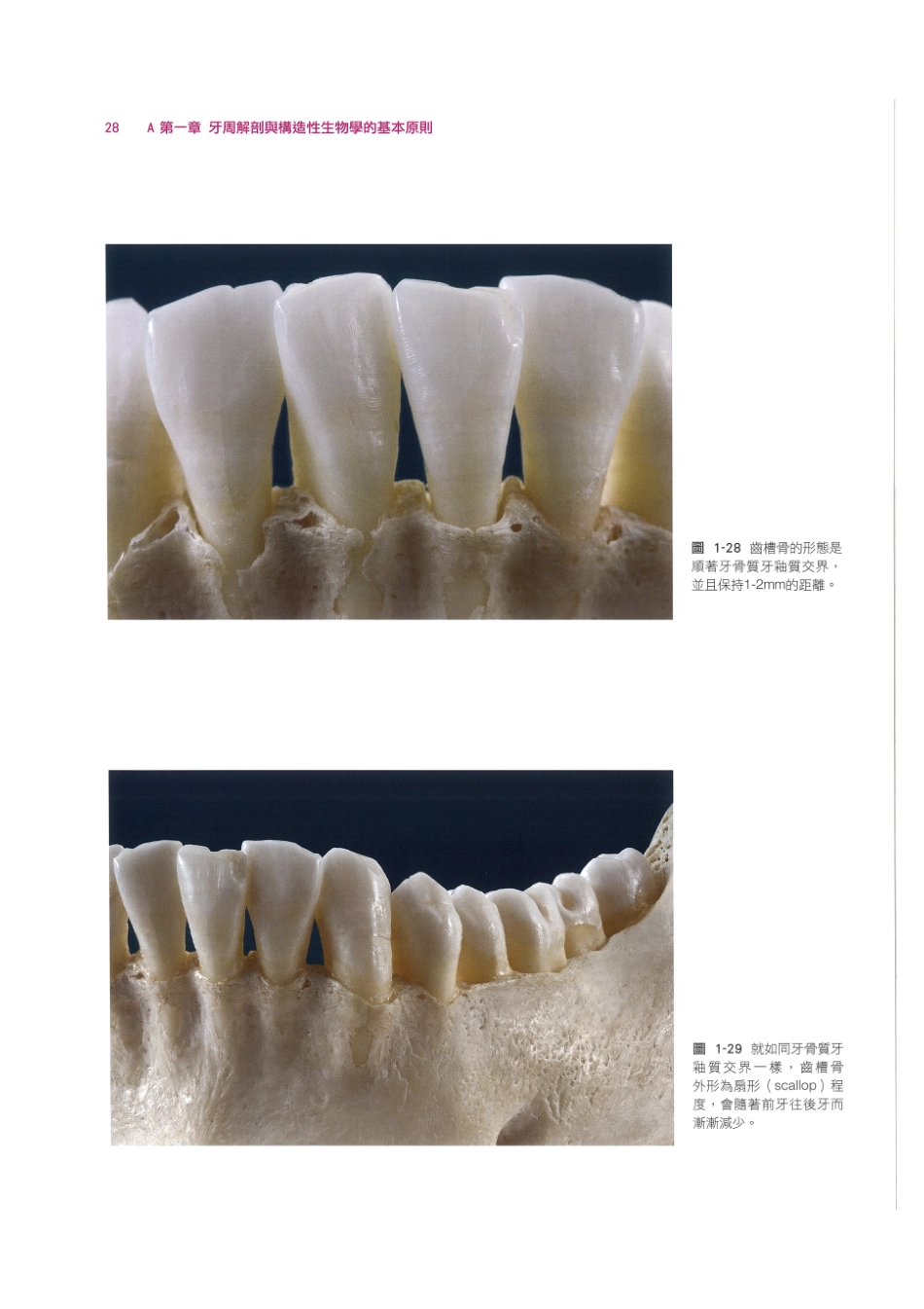 179.牙周整形美容与种植手术_41-48.pdf_第2页