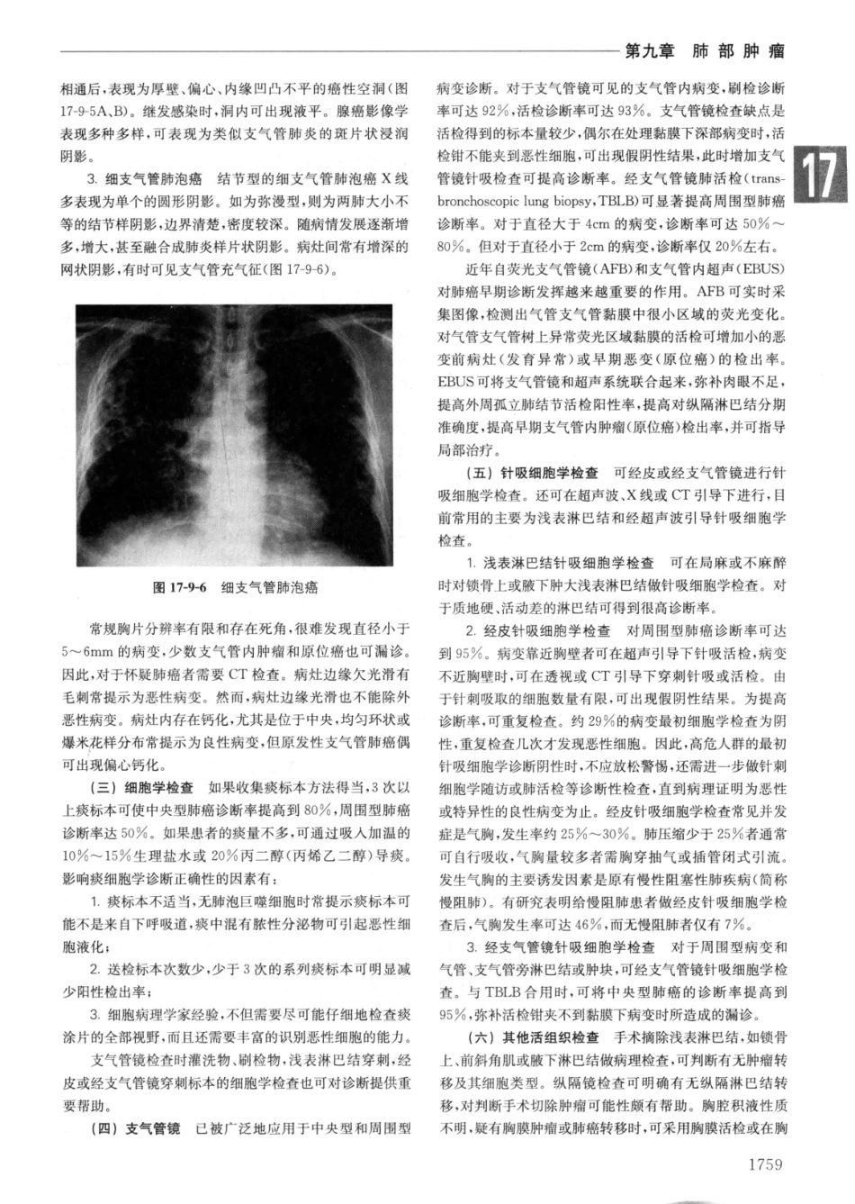 实用内科学++第14版++下_13442380_451-480.pdf_第1页