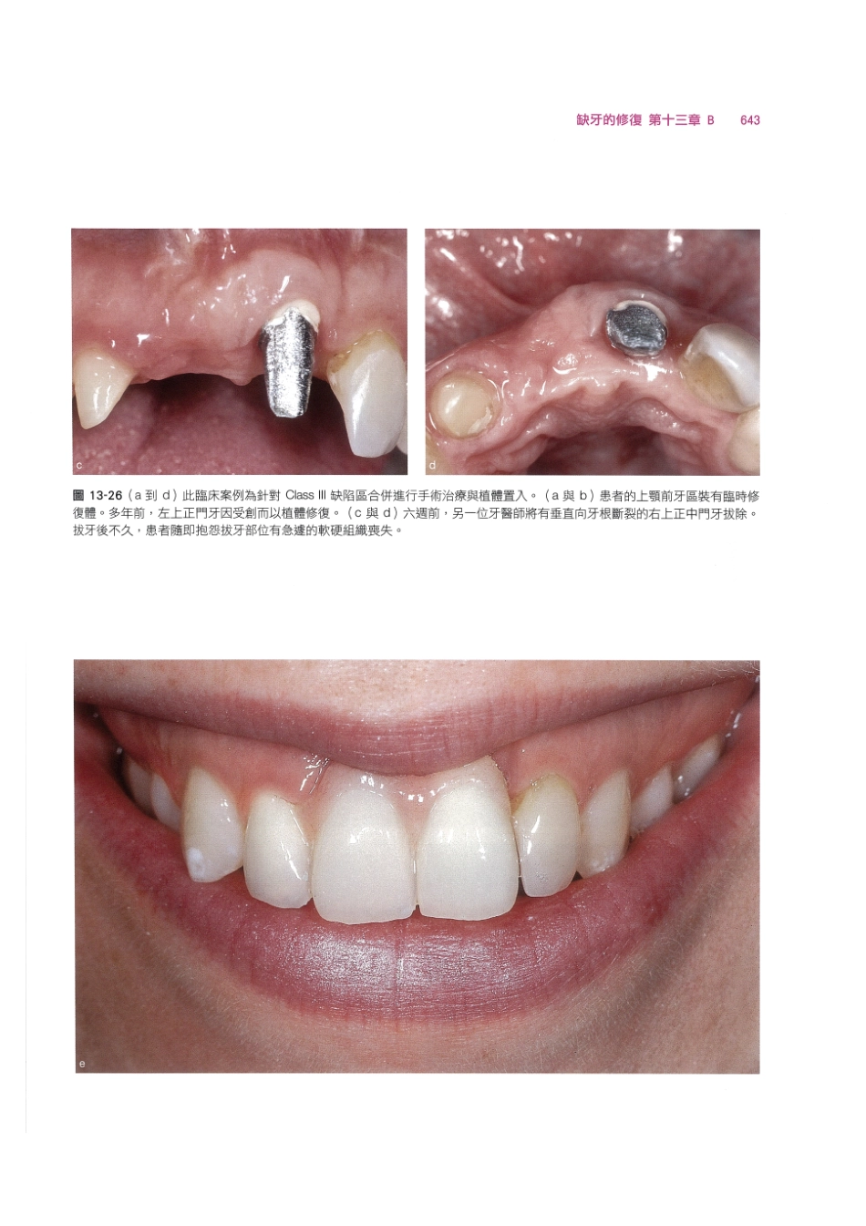 179.牙周整形美容与种植手术_657-664.pdf_第1页
