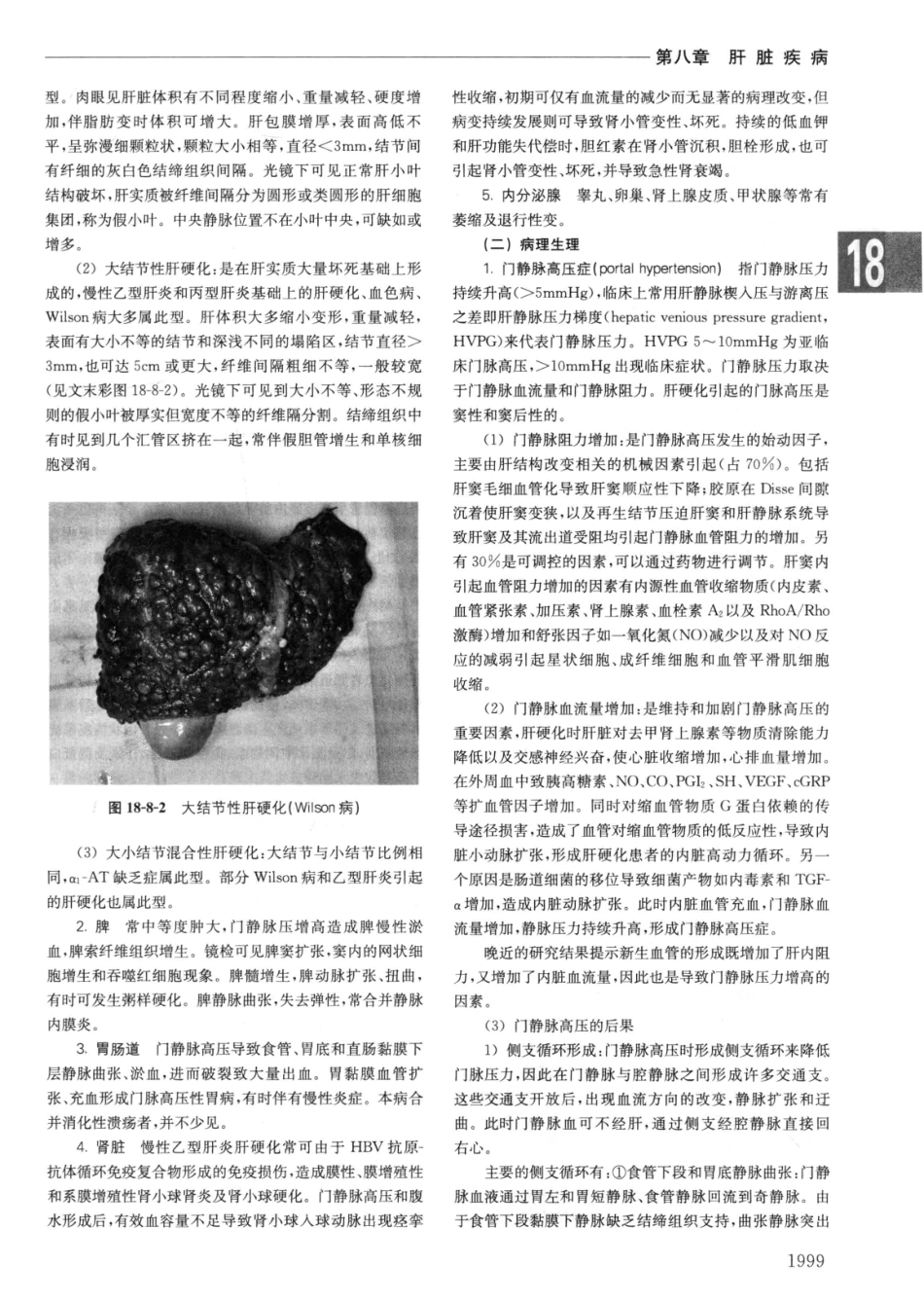 实用内科学++第14版++下_13442380_691-720.pdf_第1页