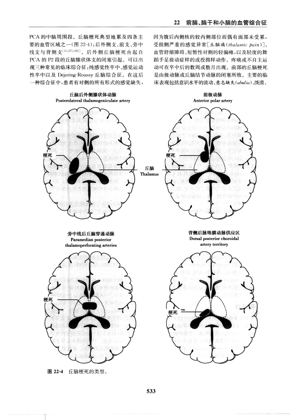 临床神经病学定位++第6版_13196861_541-555.pdf_第2页