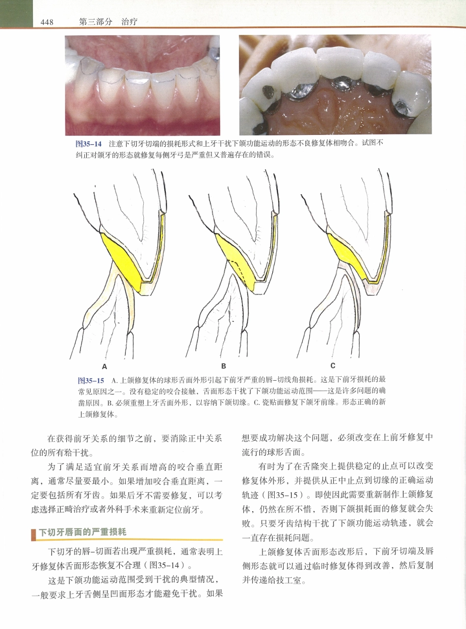 功能牙合学 从颞下颌关节到微笑设计2015年译(彩图)张豪_466-480.pdf_第1页