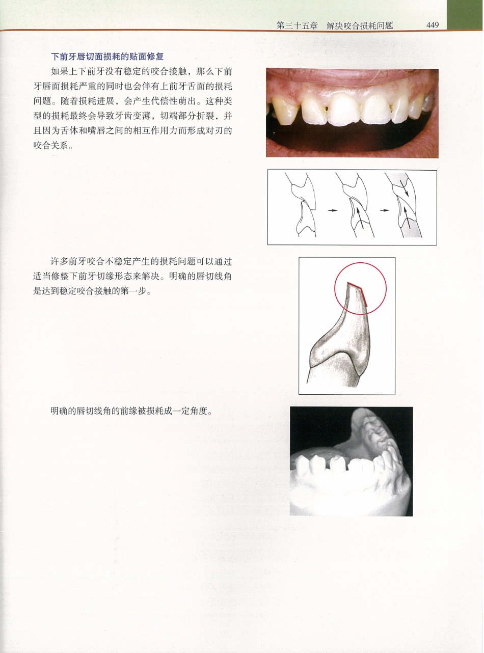 功能牙合学 从颞下颌关节到微笑设计2015年译(彩图)张豪_466-480.pdf_第2页