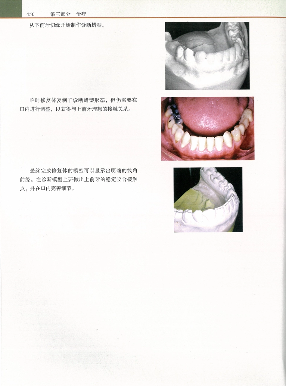 功能牙合学 从颞下颌关节到微笑设计2015年译(彩图)张豪_466-480.pdf_第3页