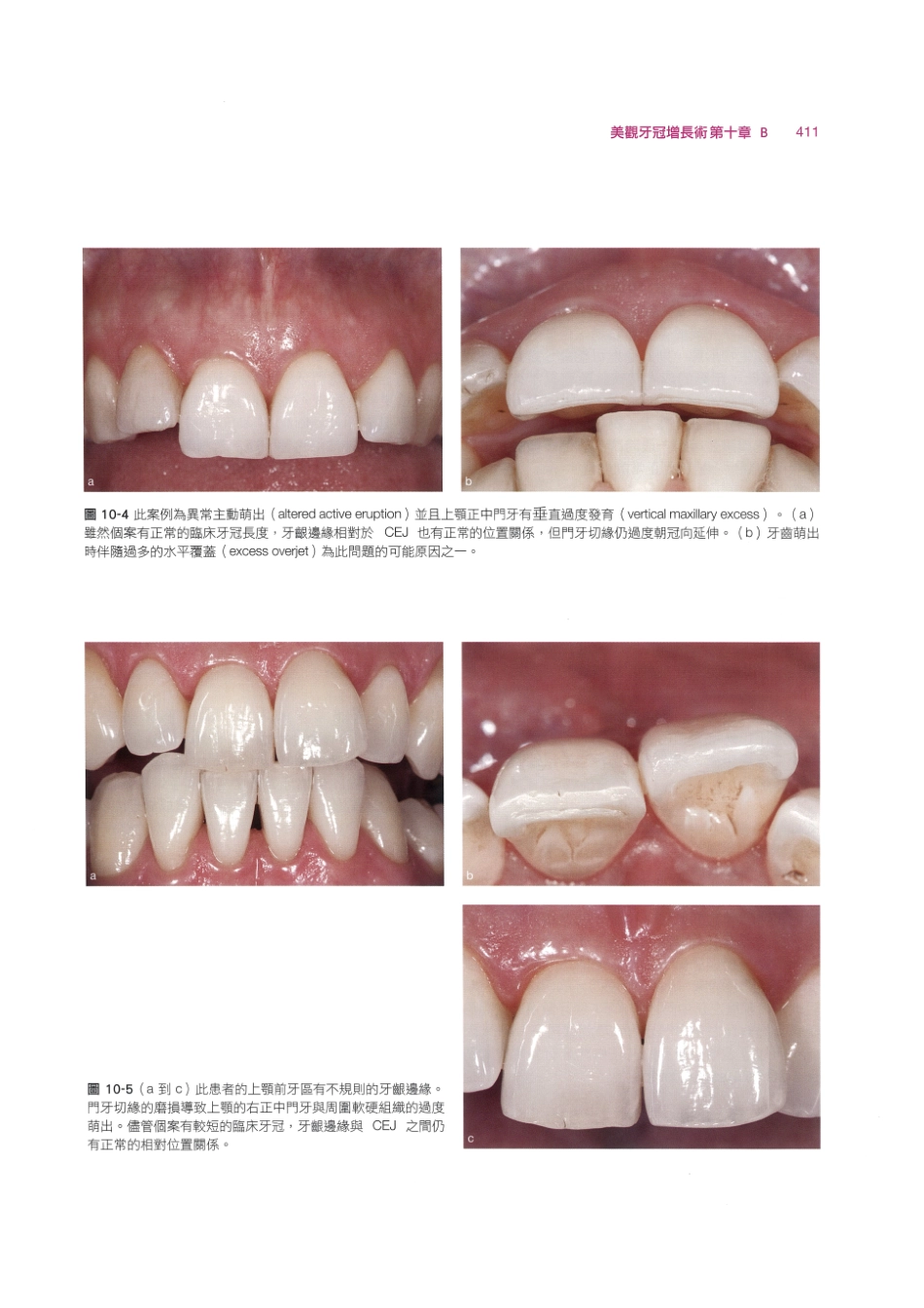 179.牙周整形美容与种植手术_425-432.pdf_第1页