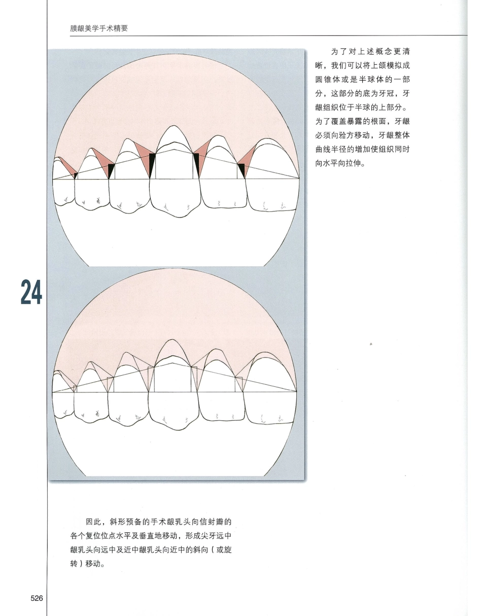 184膜龈美学手术精要_541-560.pdf_第3页