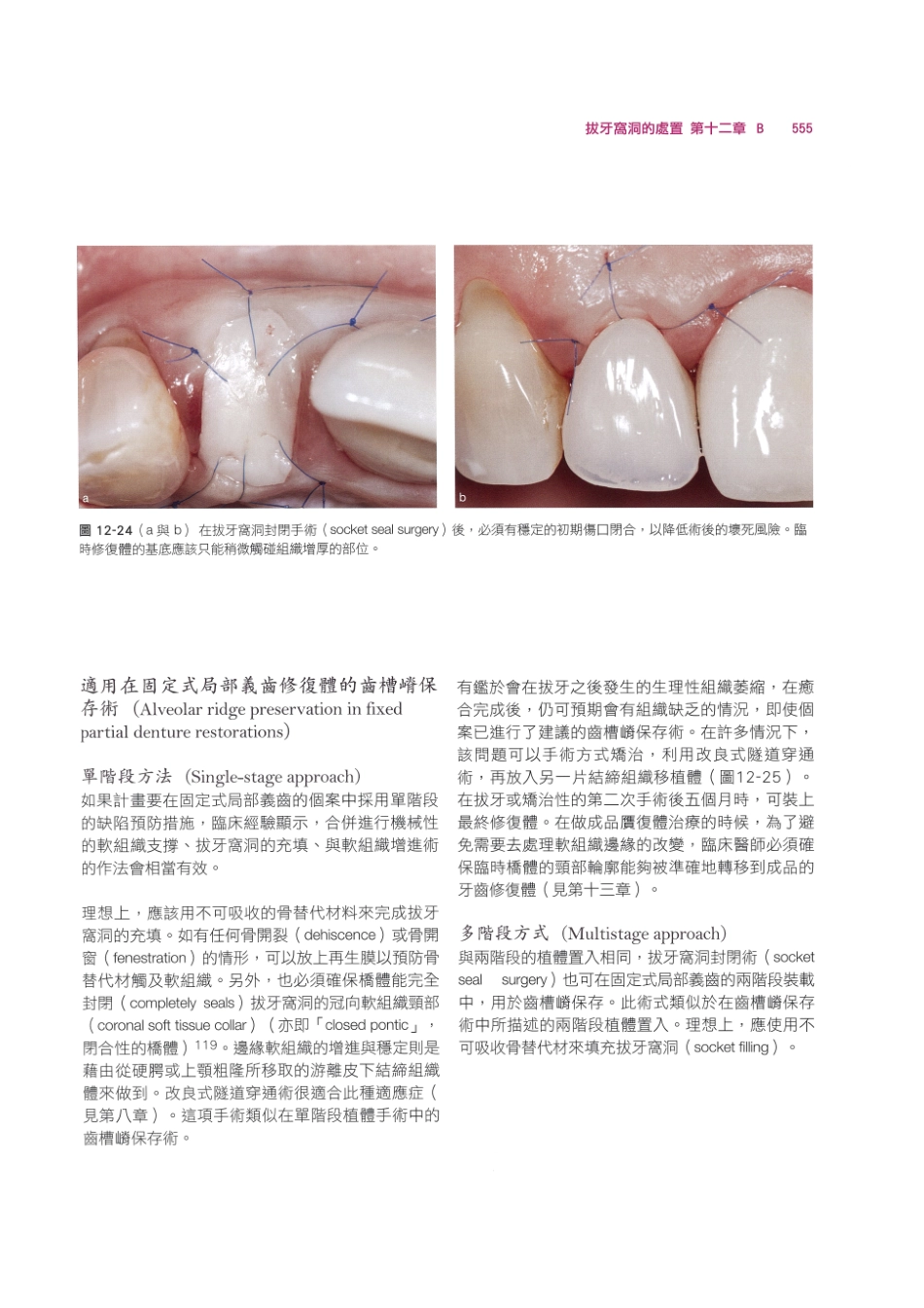 179.牙周整形美容与种植手术_569-576.pdf_第1页