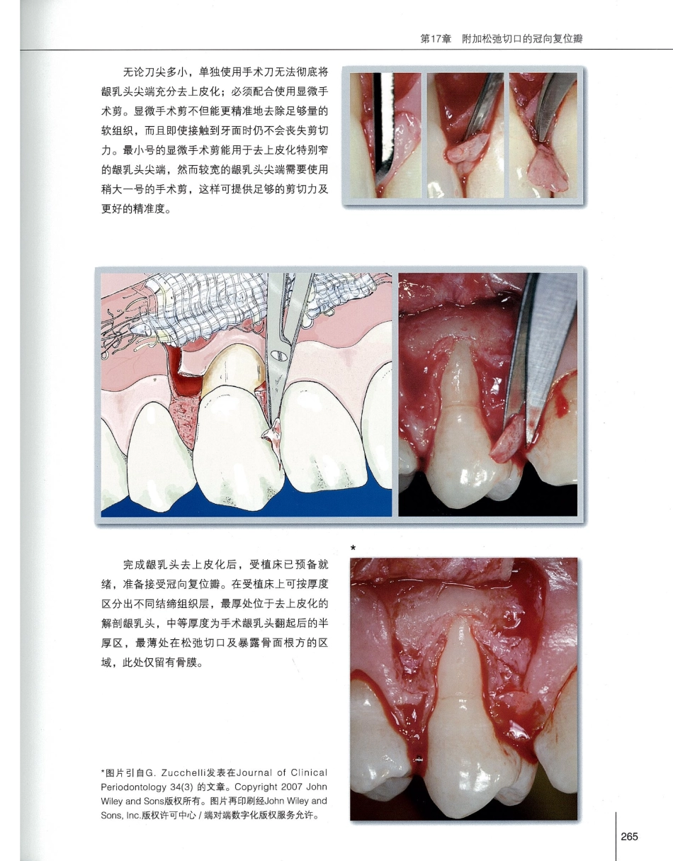 184膜龈美学手术精要_281-300.pdf_第2页