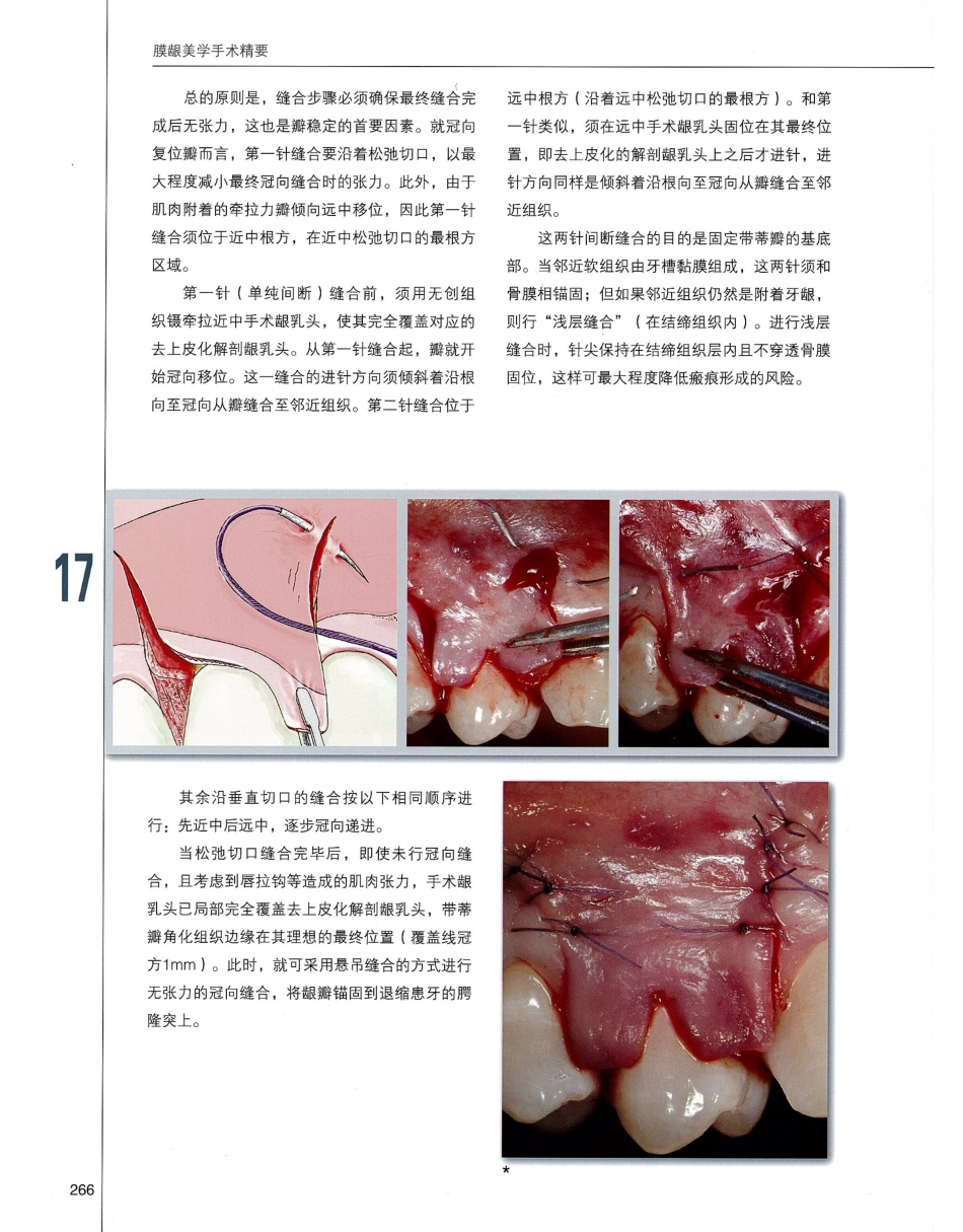 184膜龈美学手术精要_281-300.pdf_第3页