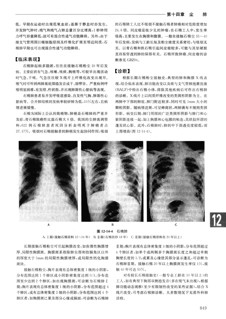 实用内科学++第14版++上_13442332_876-900.pdf_第1页