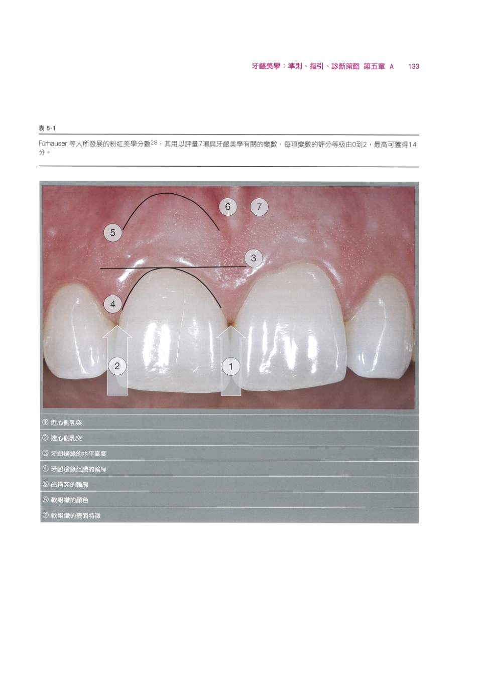 179.牙周整形美容与种植手术_145-152.pdf_第3页