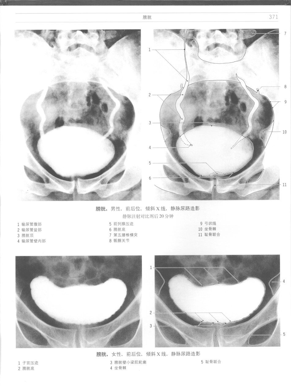 影像解剖学_11724881_373-384.pdf_第1页