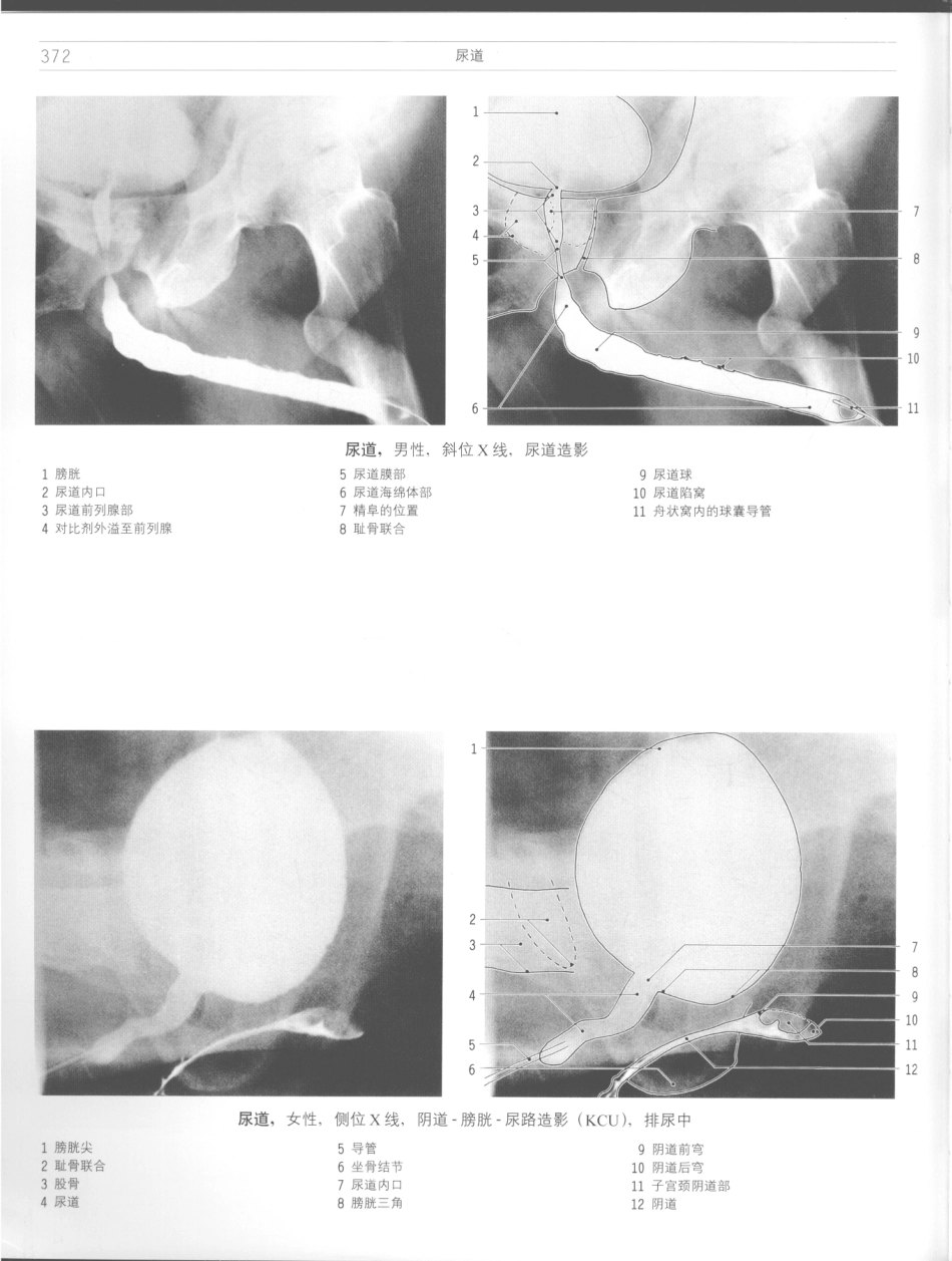 影像解剖学_11724881_373-384.pdf_第2页