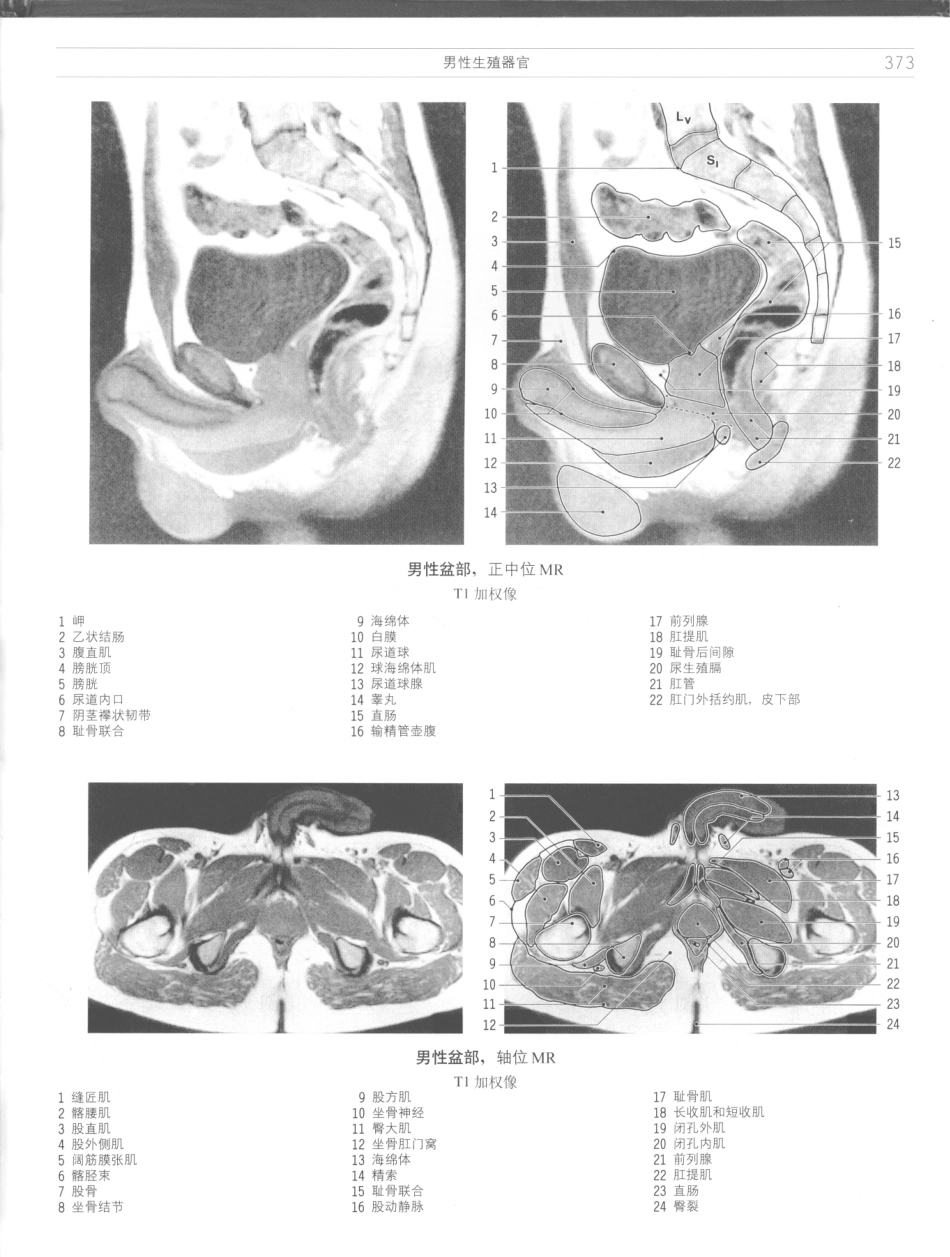 影像解剖学_11724881_373-384.pdf_第3页