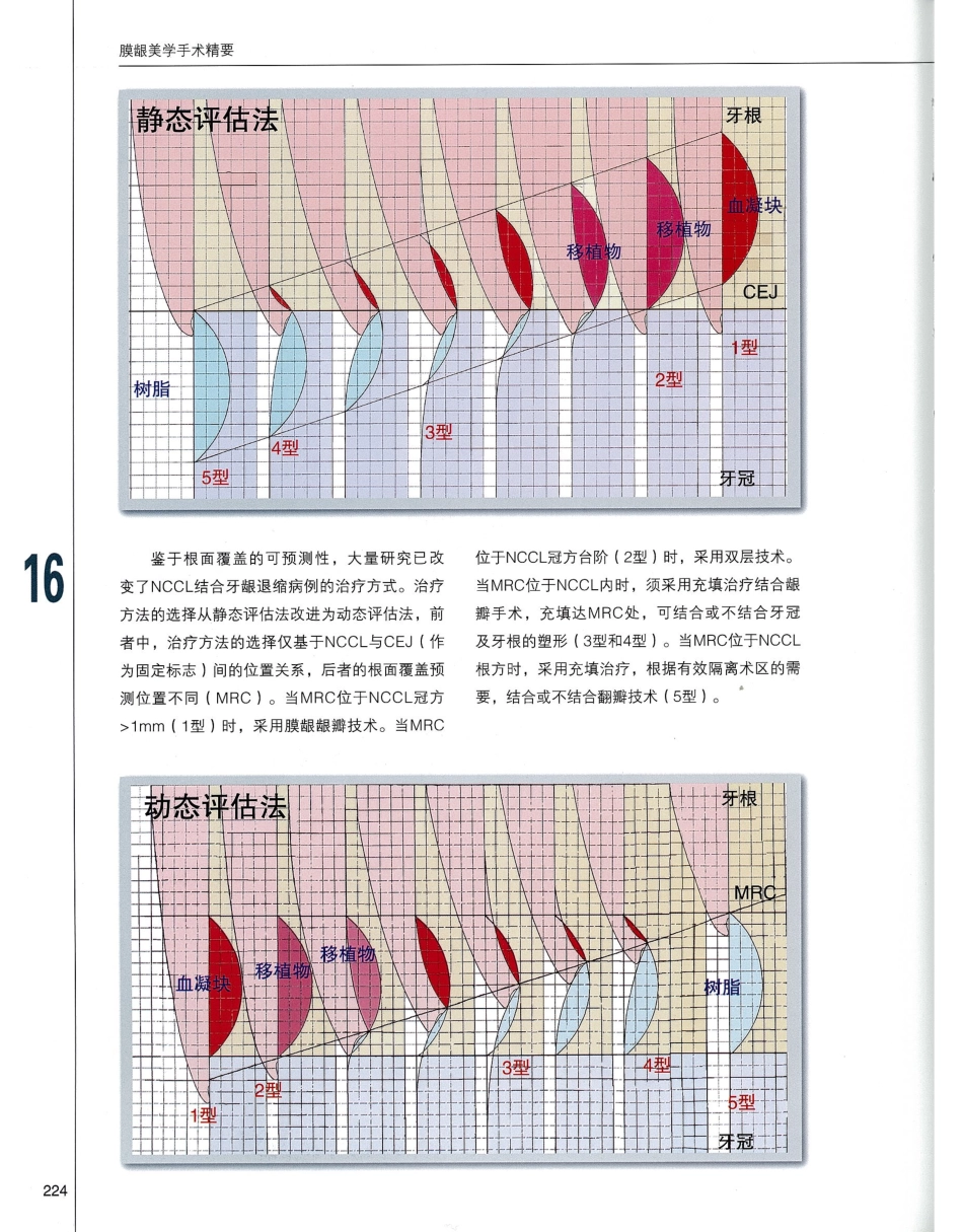 184膜龈美学手术精要_241-260.pdf_第1页