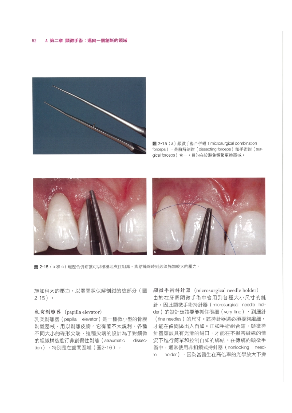 179.牙周整形美容与种植手术_65-72.pdf_第2页
