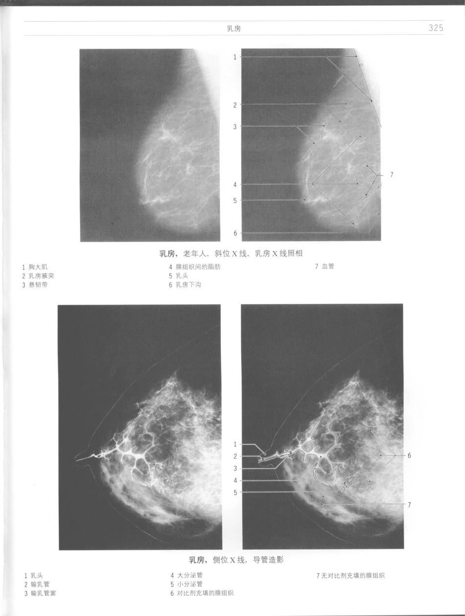 影像解剖学_11724881_325-336.pdf_第3页