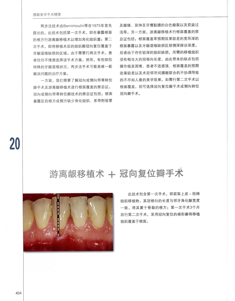 184膜龈美学手术精要_421-440.pdf_第1页