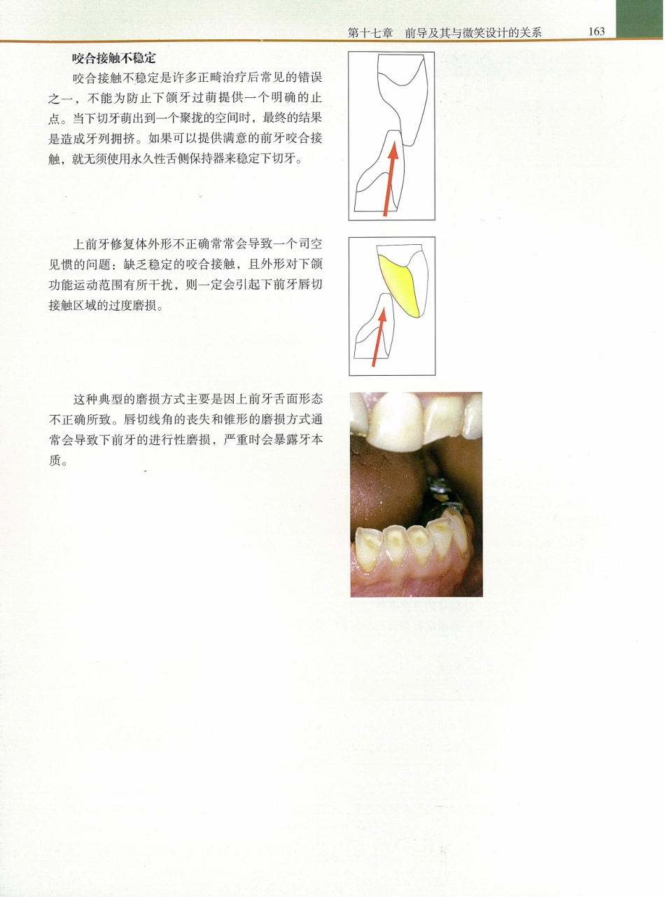 功能牙合学 从颞下颌关节到微笑设计2015年译(彩图)张豪_181-195.pdf_第1页