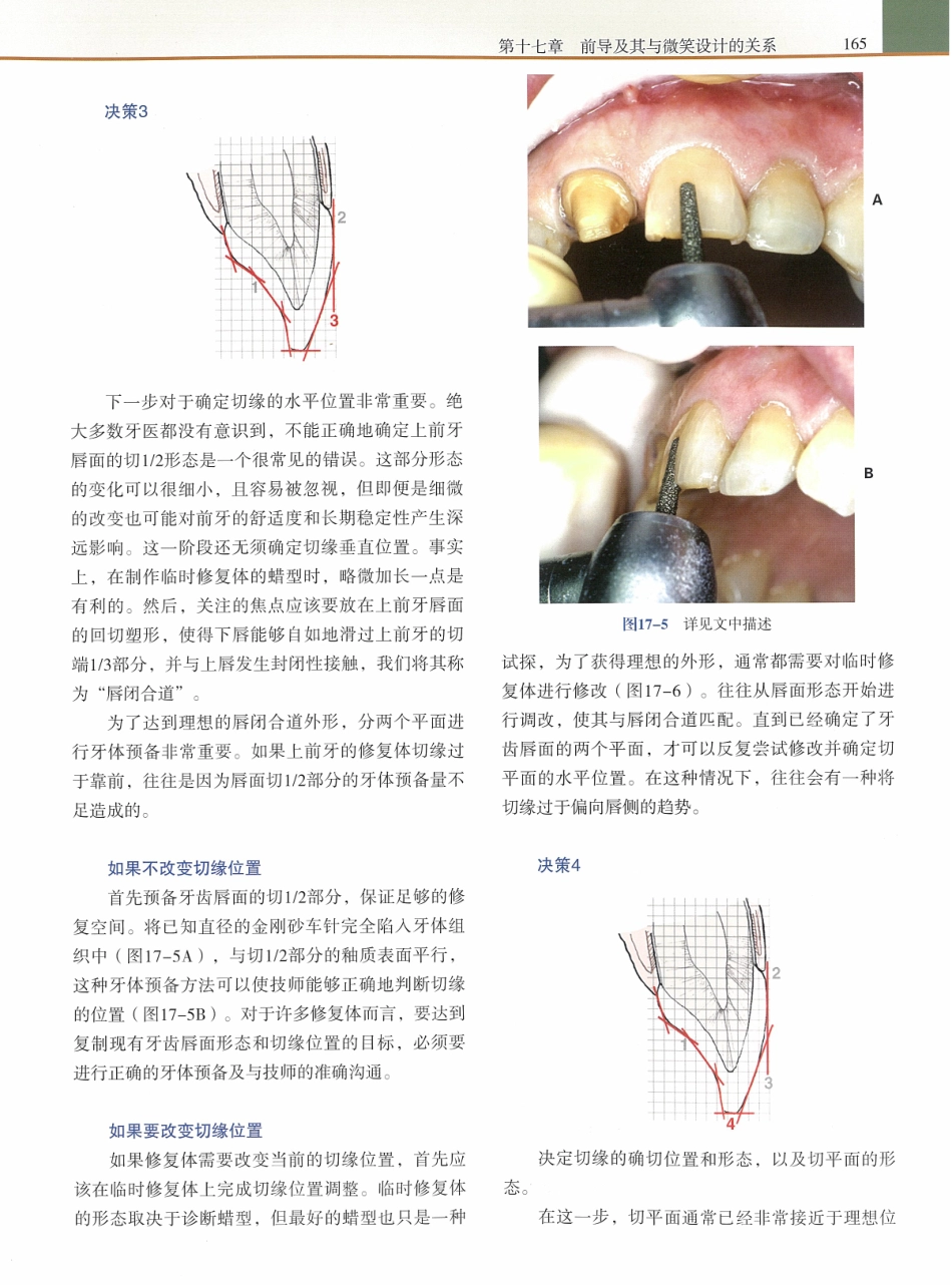 功能牙合学 从颞下颌关节到微笑设计2015年译(彩图)张豪_181-195.pdf_第3页