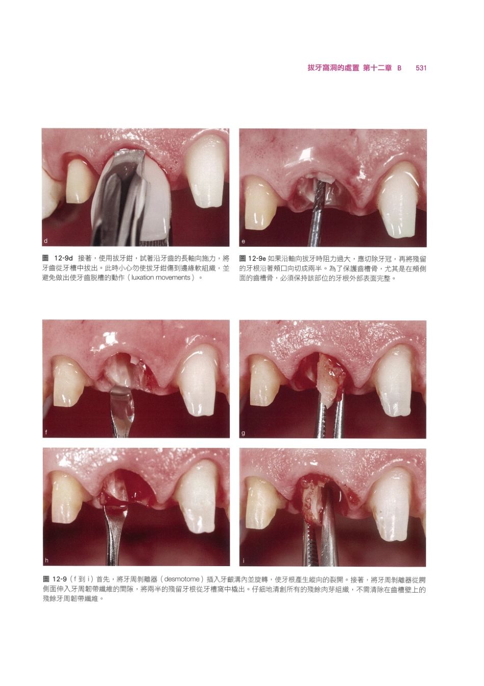 179.牙周整形美容与种植手术_545-552.pdf_第1页