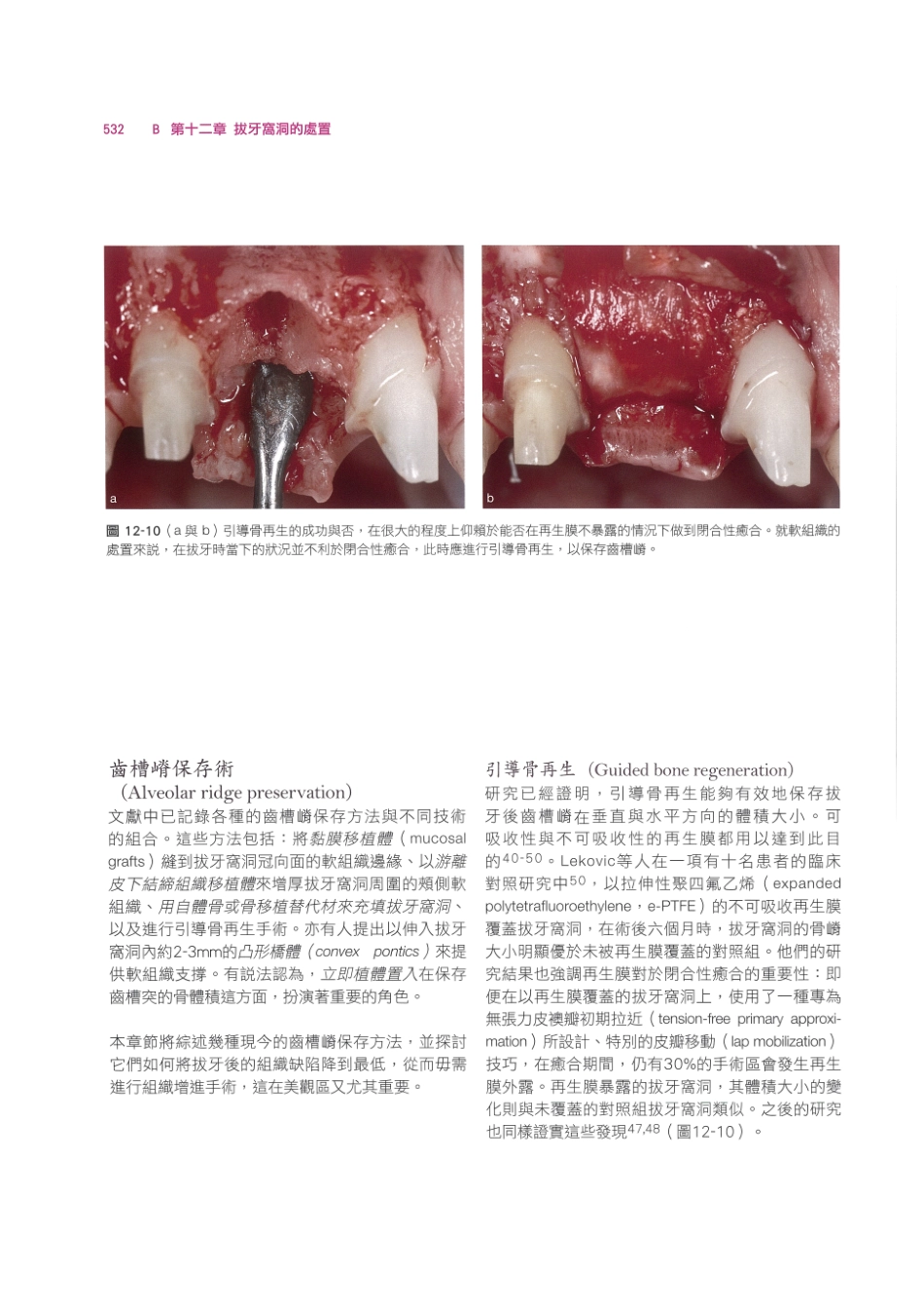 179.牙周整形美容与种植手术_545-552.pdf_第2页