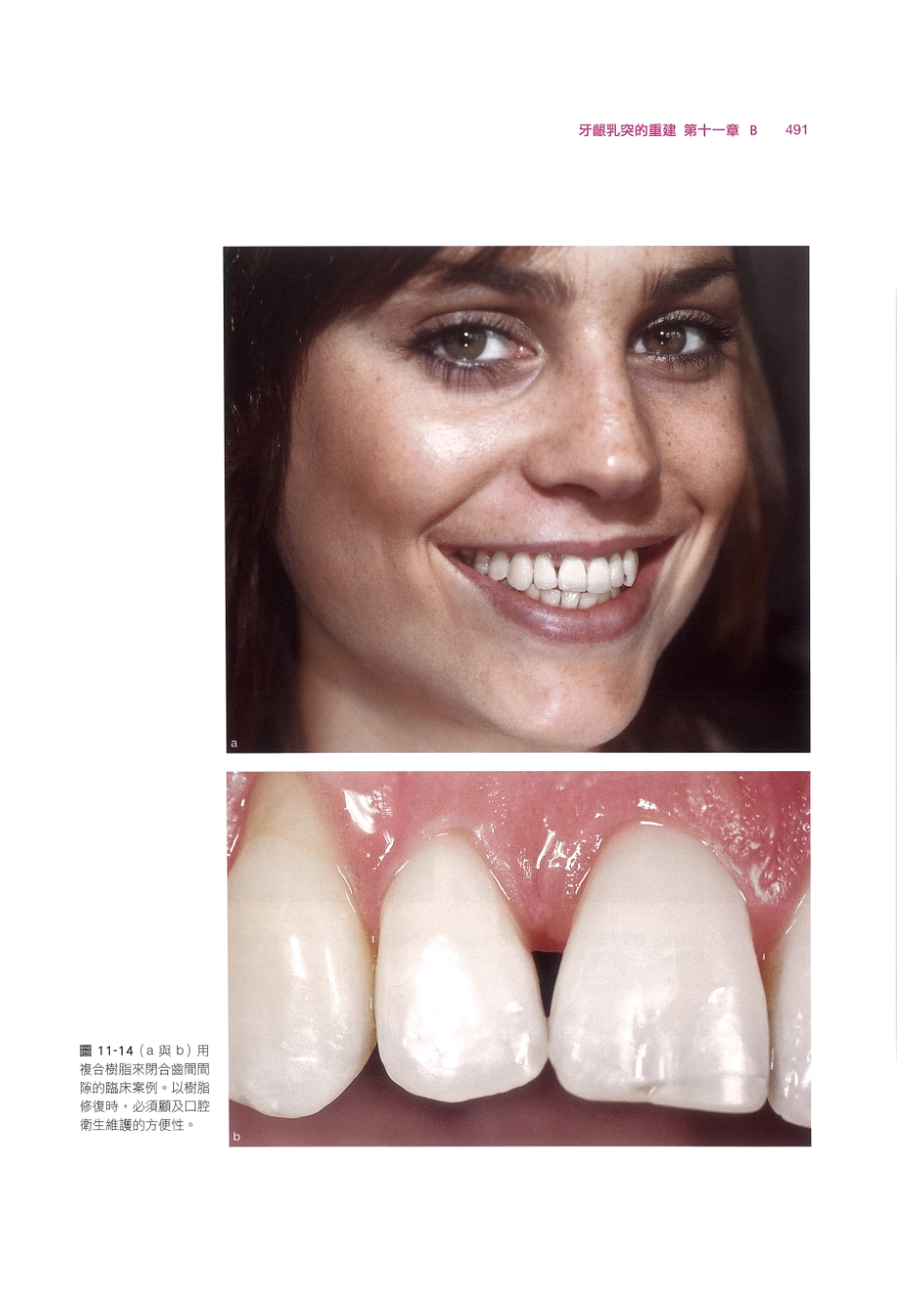 179.牙周整形美容与种植手术_505-512.pdf_第1页