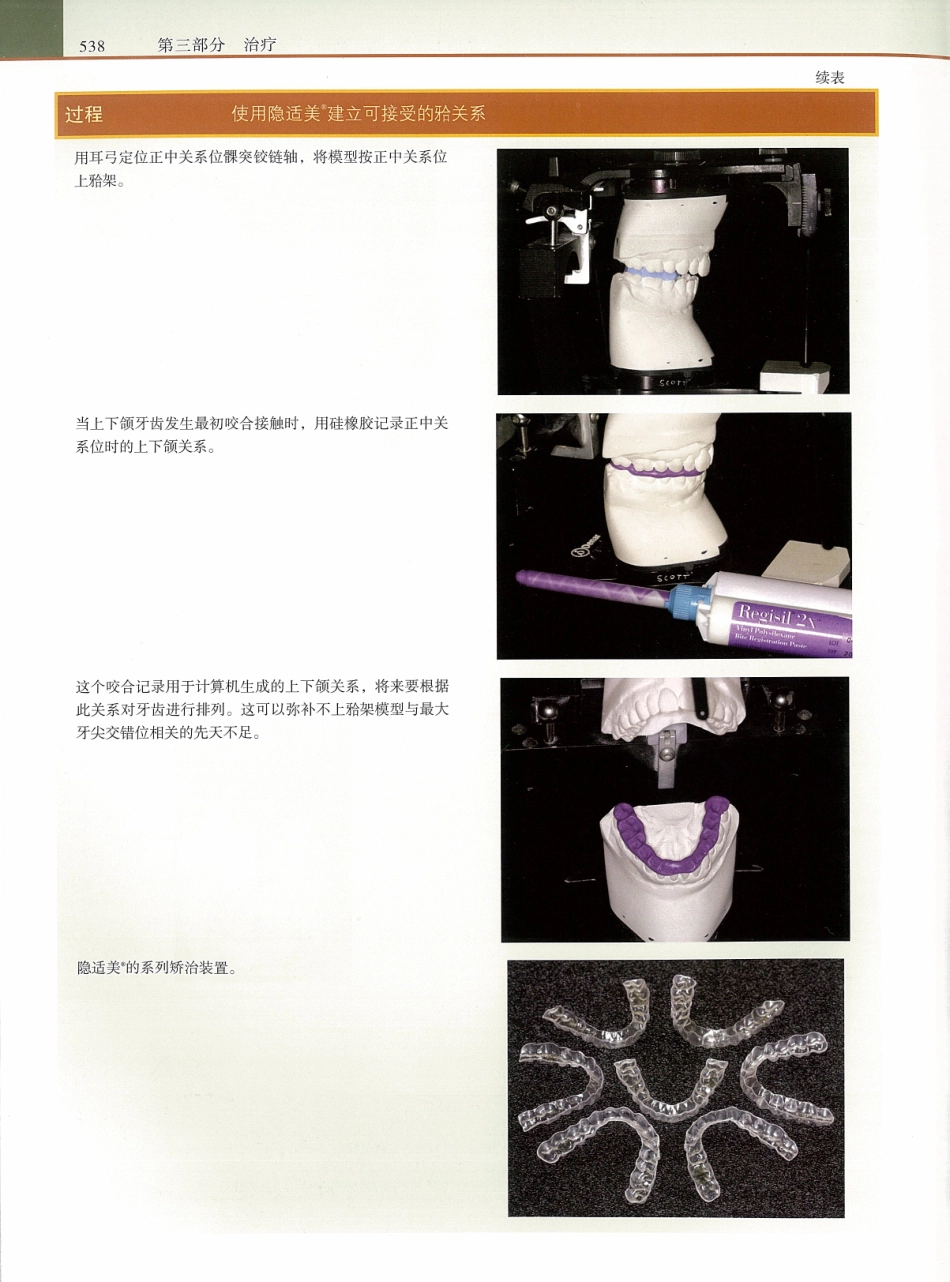功能牙合学 从颞下颌关节到微笑设计2015年译(彩图)张豪_556-570.pdf_第1页