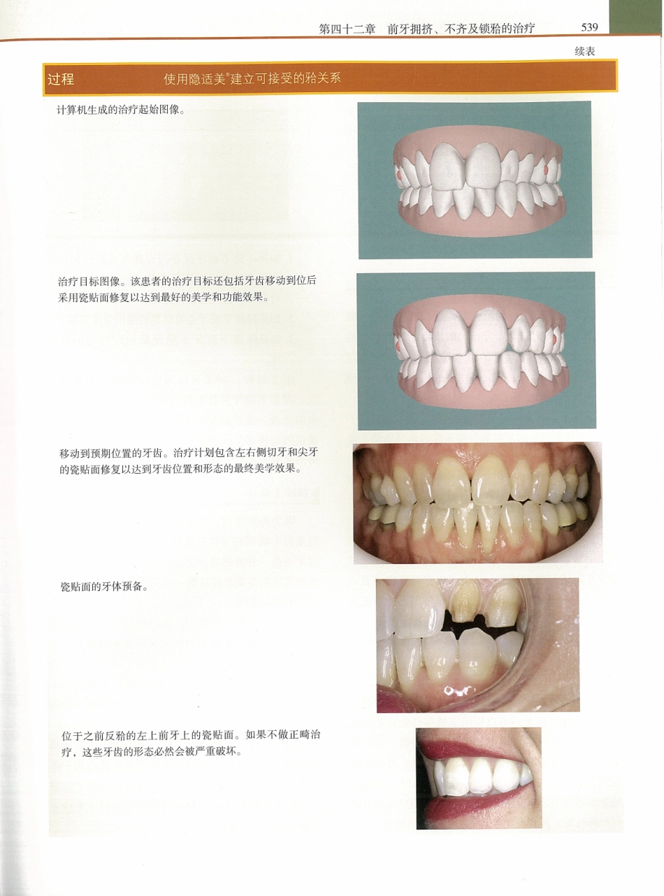 功能牙合学 从颞下颌关节到微笑设计2015年译(彩图)张豪_556-570.pdf_第2页
