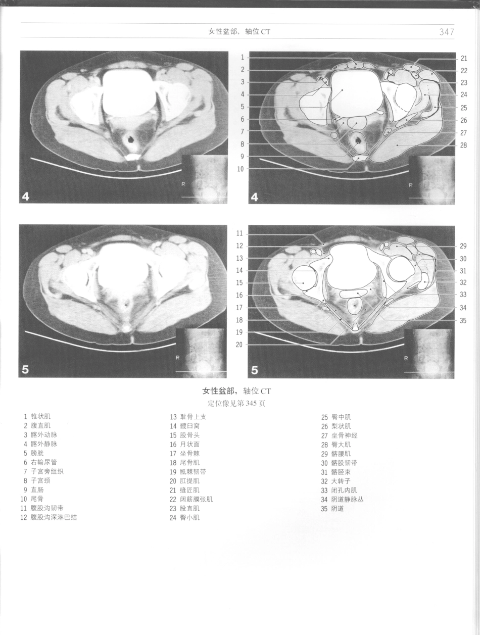 影像解剖学_11724881_349-360.pdf_第1页