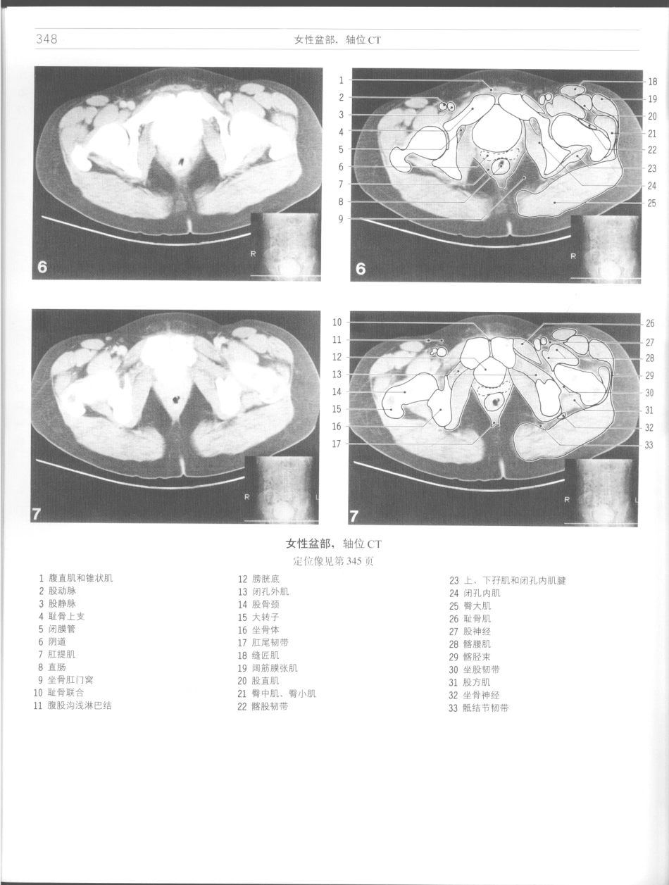 影像解剖学_11724881_349-360.pdf_第2页