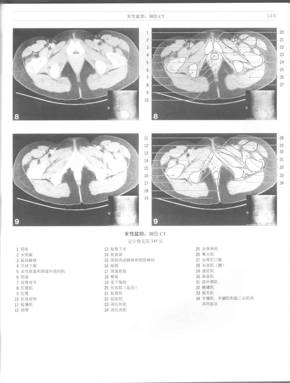 影像解剖学_11724881_349-360.pdf_第3页