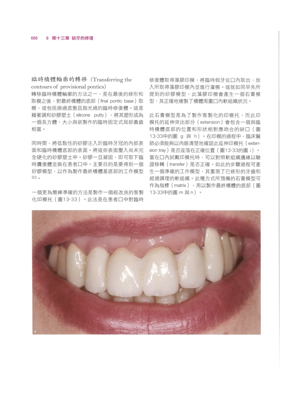 179.牙周整形美容与种植手术_681-688.pdf_第2页