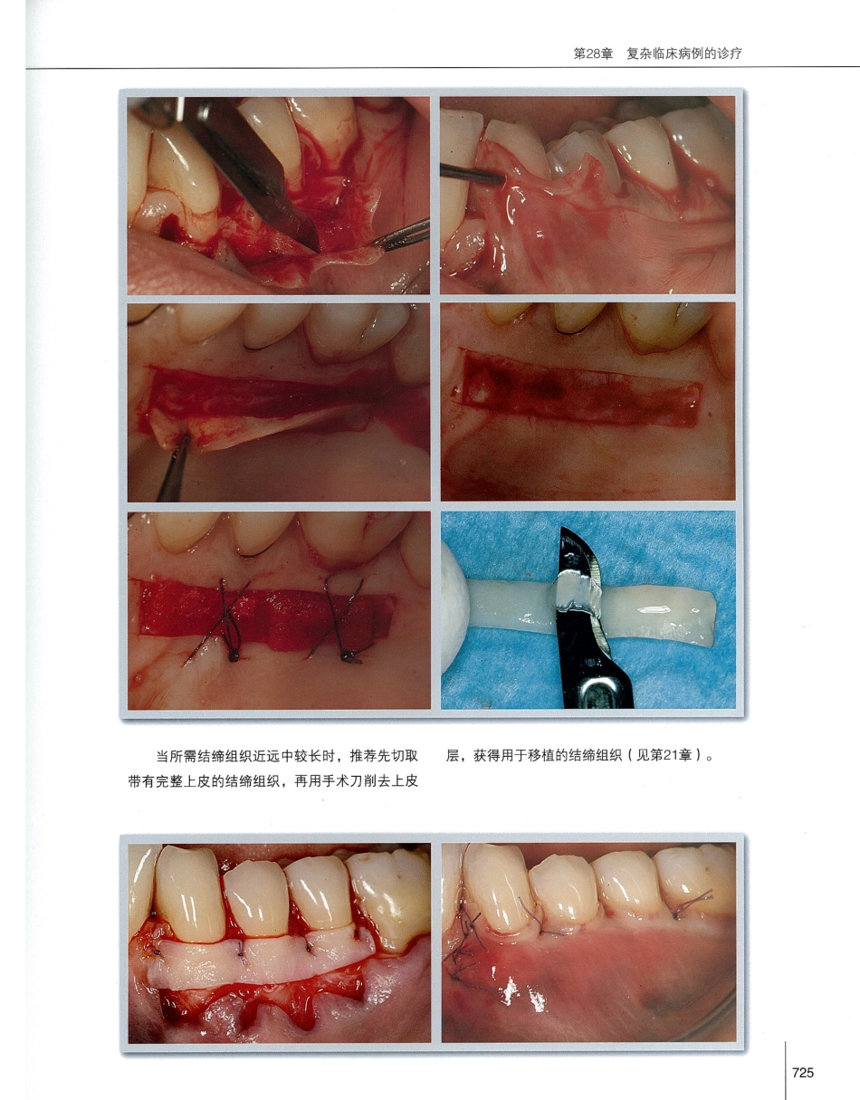 184膜龈美学手术精要_741-760.pdf_第2页