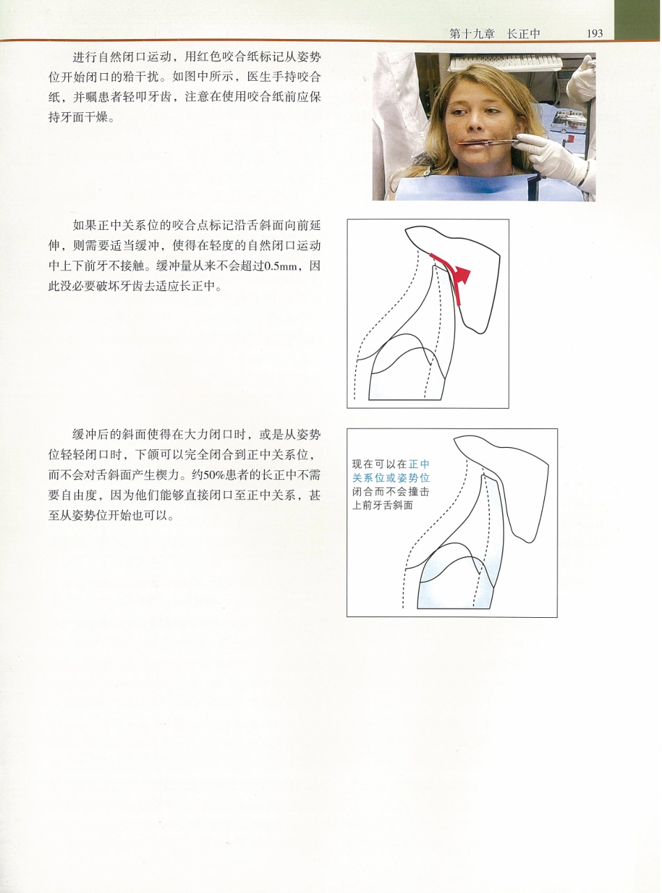 功能牙合学 从颞下颌关节到微笑设计2015年译(彩图)张豪_211-225.pdf_第1页