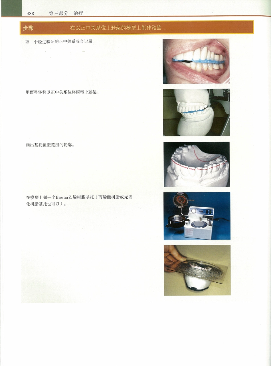 功能牙合学 从颞下颌关节到微笑设计2015年译(彩图)张豪_406-420.pdf_第1页