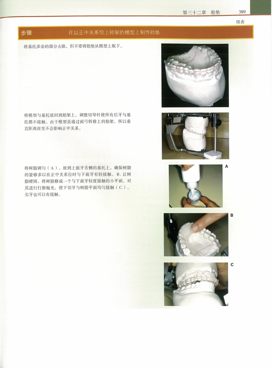功能牙合学 从颞下颌关节到微笑设计2015年译(彩图)张豪_406-420.pdf_第2页