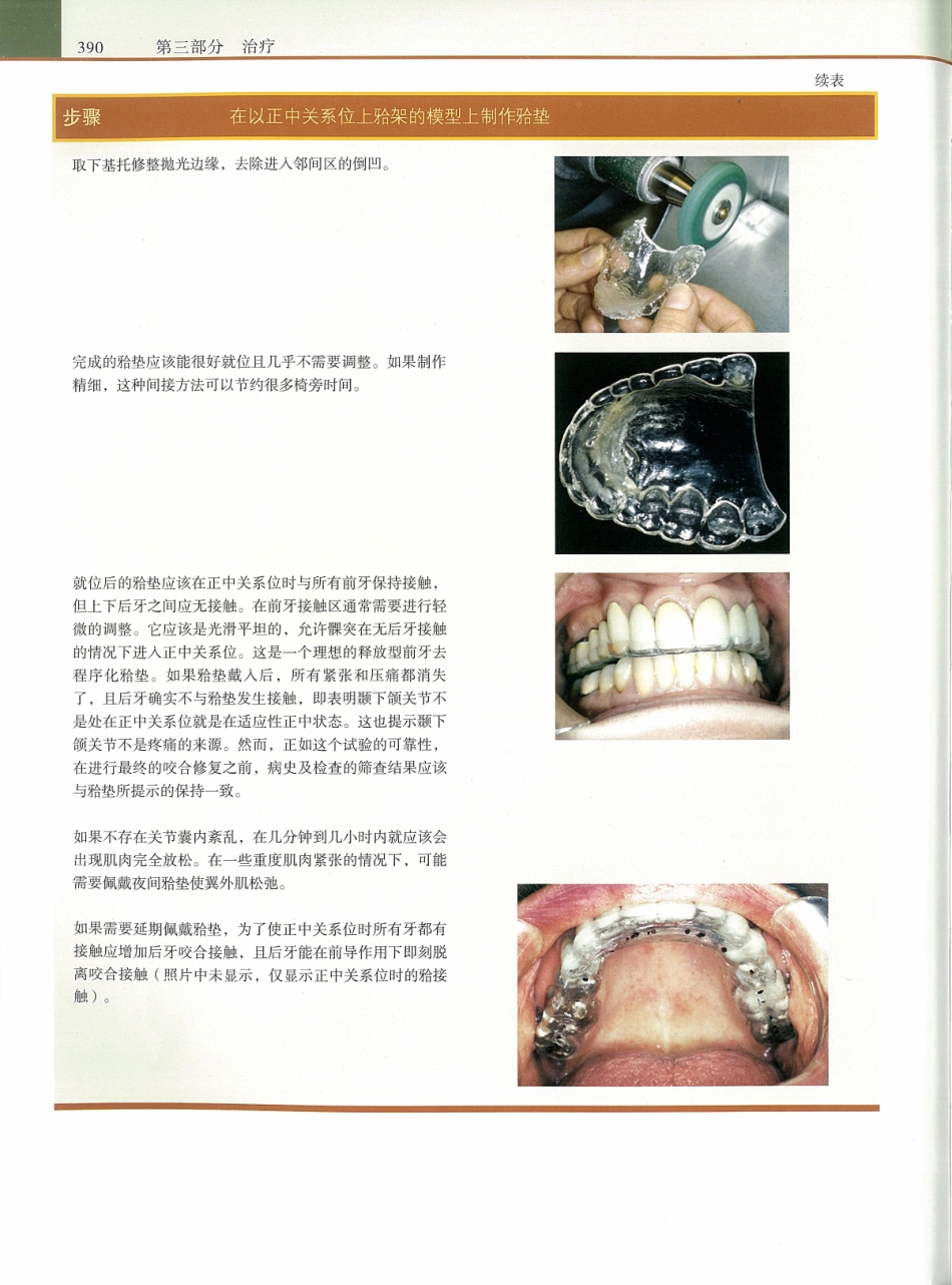 功能牙合学 从颞下颌关节到微笑设计2015年译(彩图)张豪_406-420.pdf_第3页