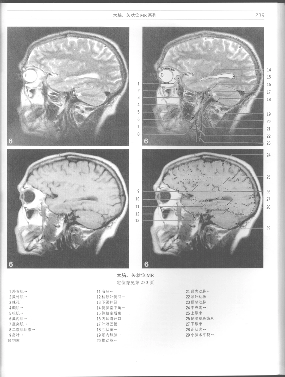 影像解剖学_11724881_241-252.pdf_第1页