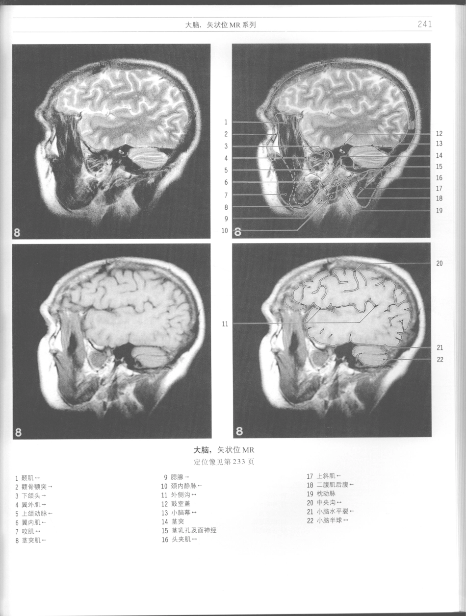 影像解剖学_11724881_241-252.pdf_第3页