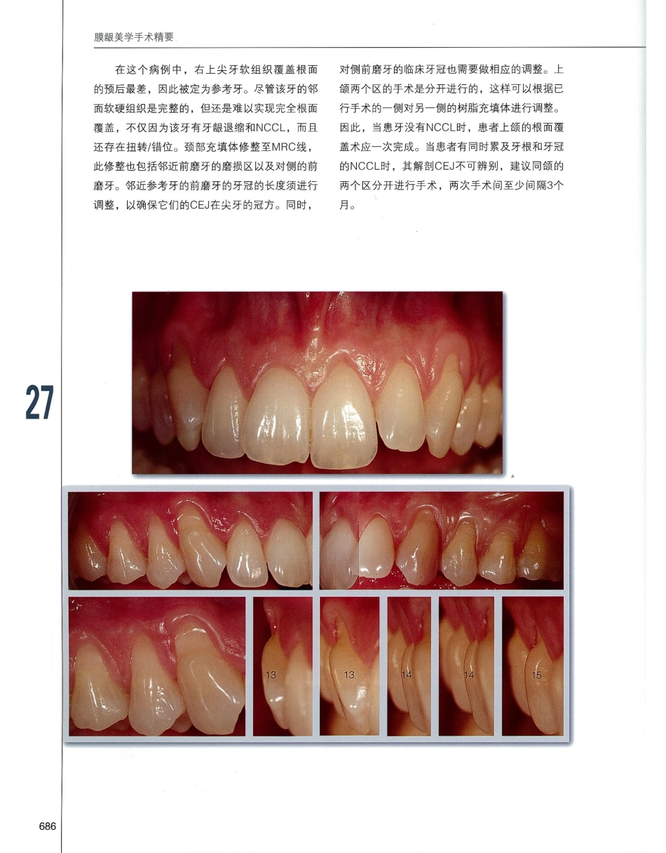 184膜龈美学手术精要_701-720.pdf_第3页