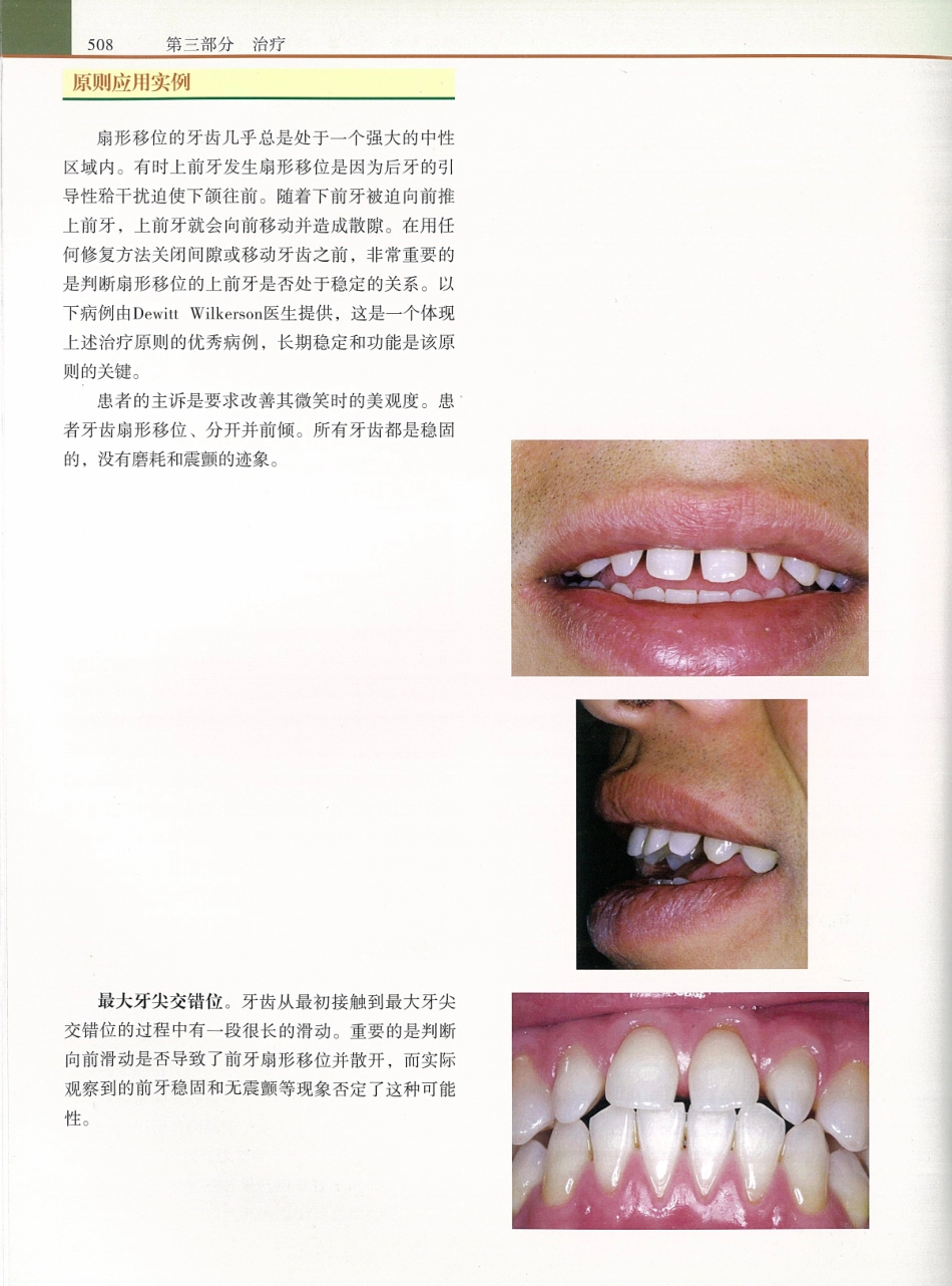 功能牙合学 从颞下颌关节到微笑设计2015年译(彩图)张豪_526-540.pdf_第1页