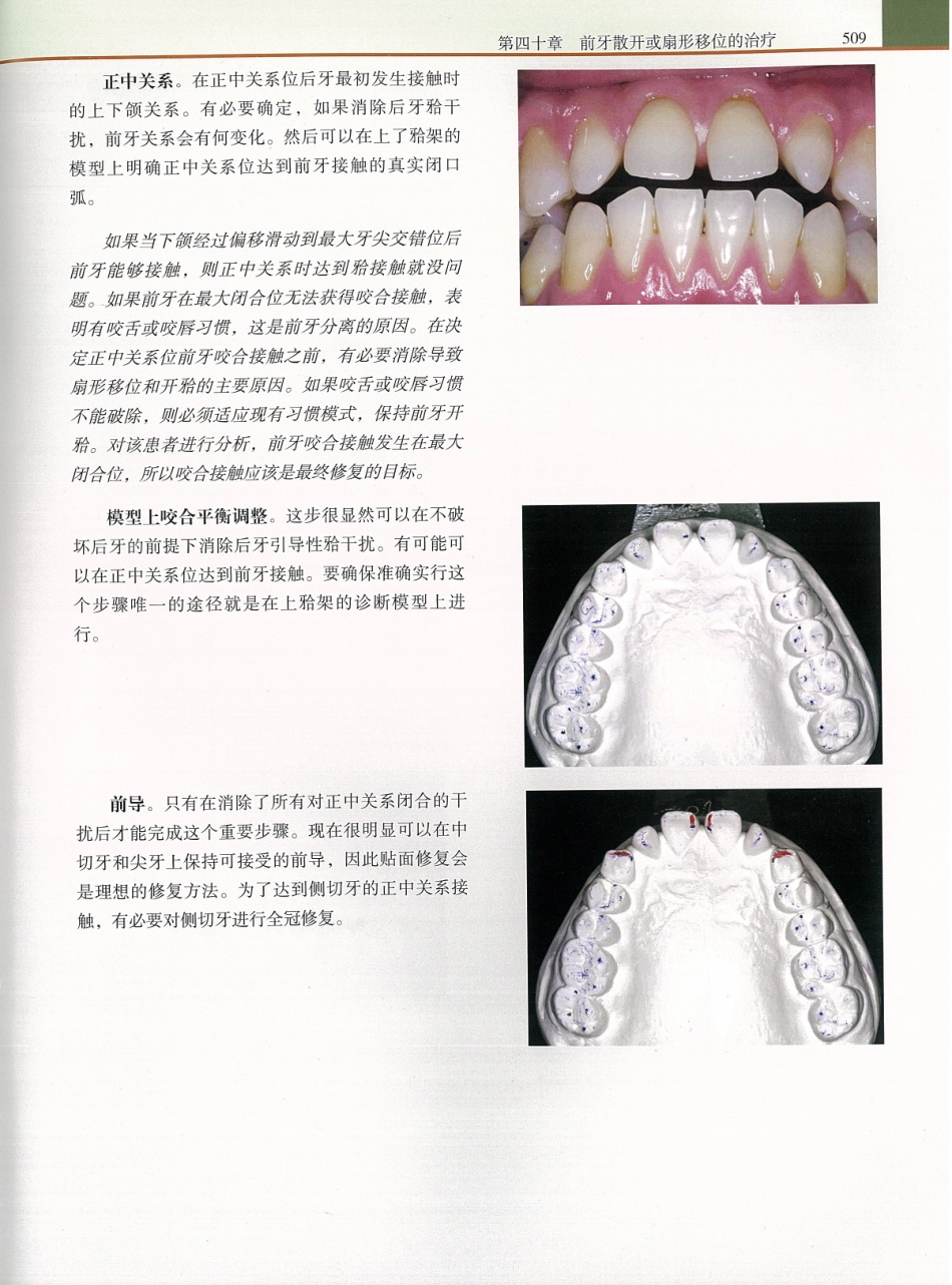 功能牙合学 从颞下颌关节到微笑设计2015年译(彩图)张豪_526-540.pdf_第2页