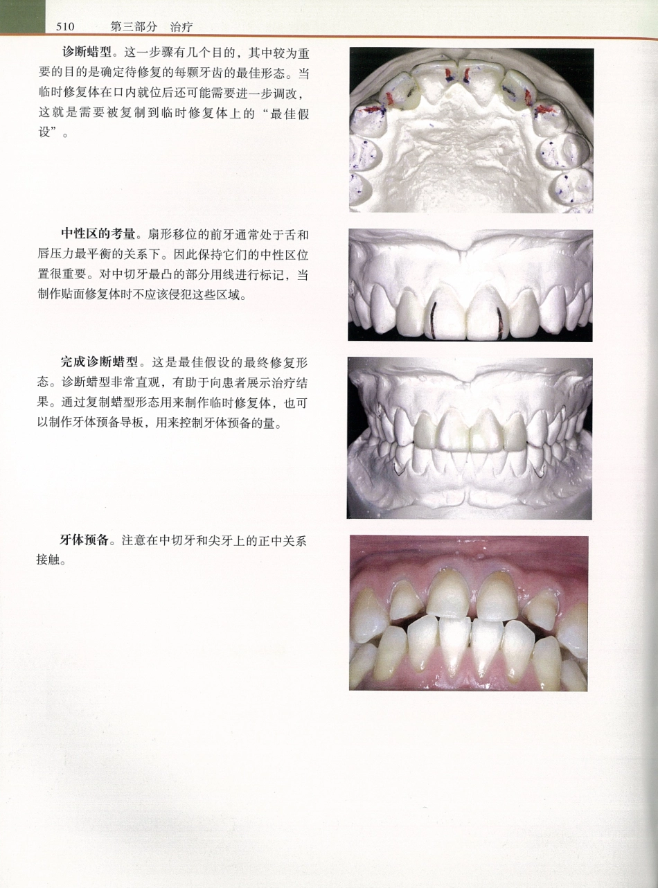 功能牙合学 从颞下颌关节到微笑设计2015年译(彩图)张豪_526-540.pdf_第3页