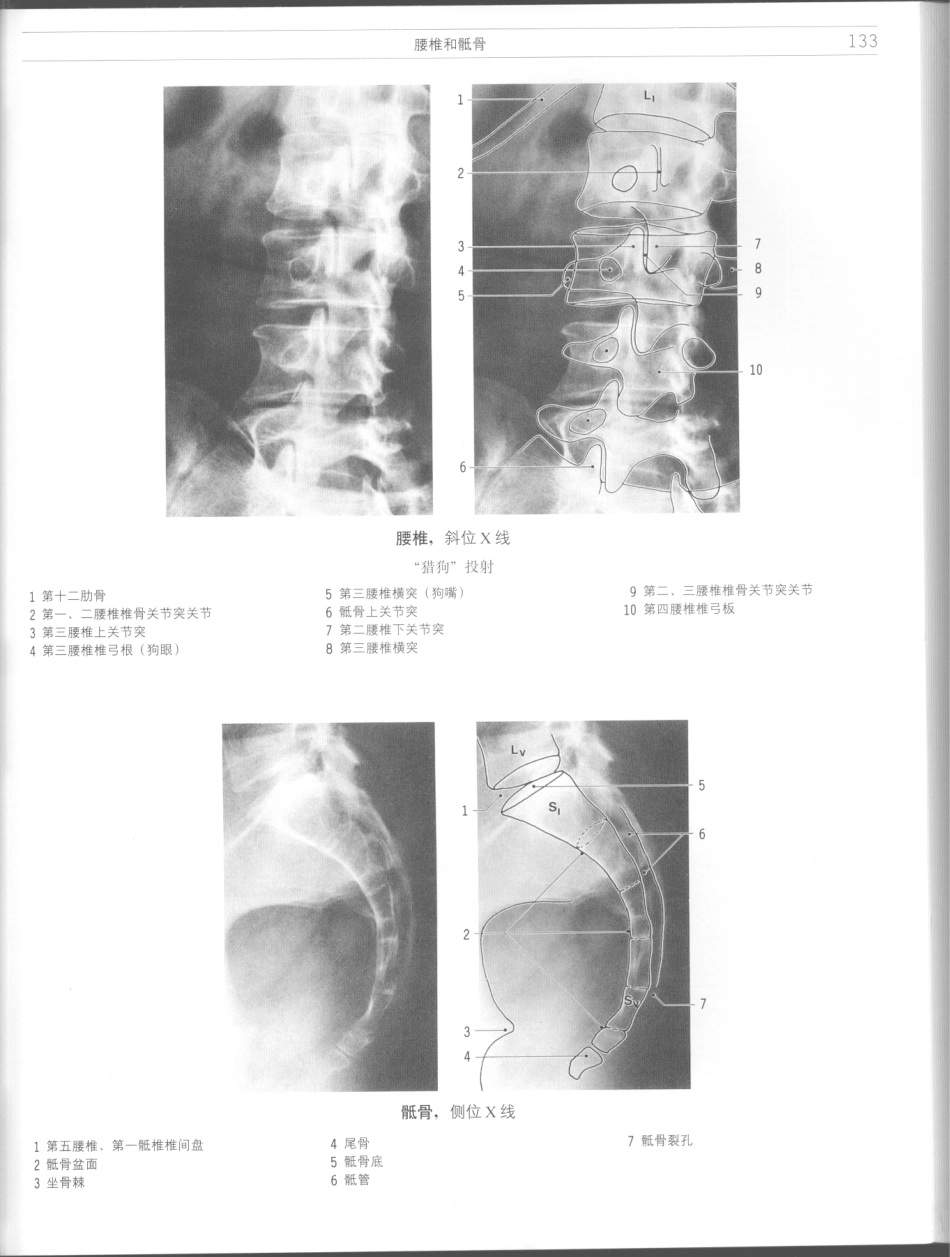 影像解剖学_11724881_133-144.pdf_第3页