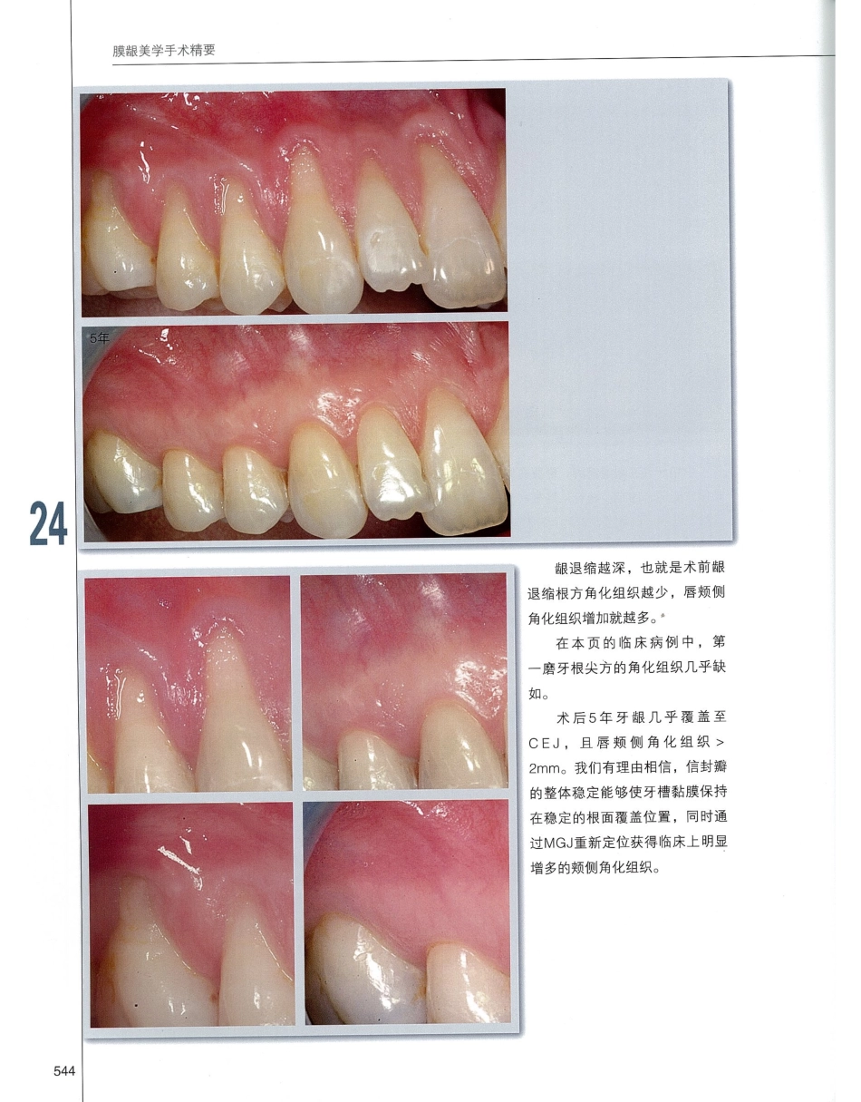 184膜龈美学手术精要_561-580.pdf_第1页
