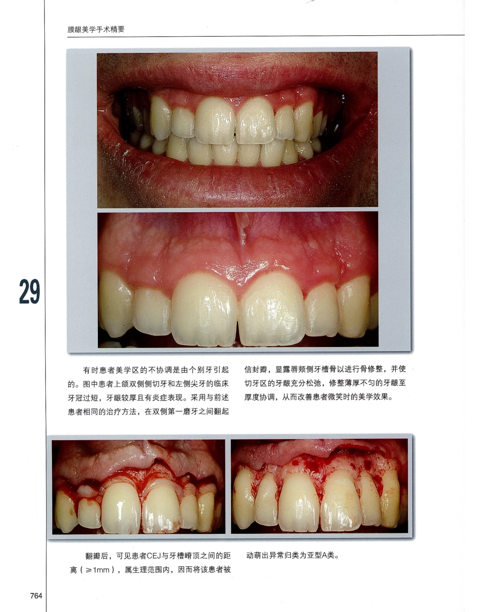 184膜龈美学手术精要_781-800.pdf_第1页