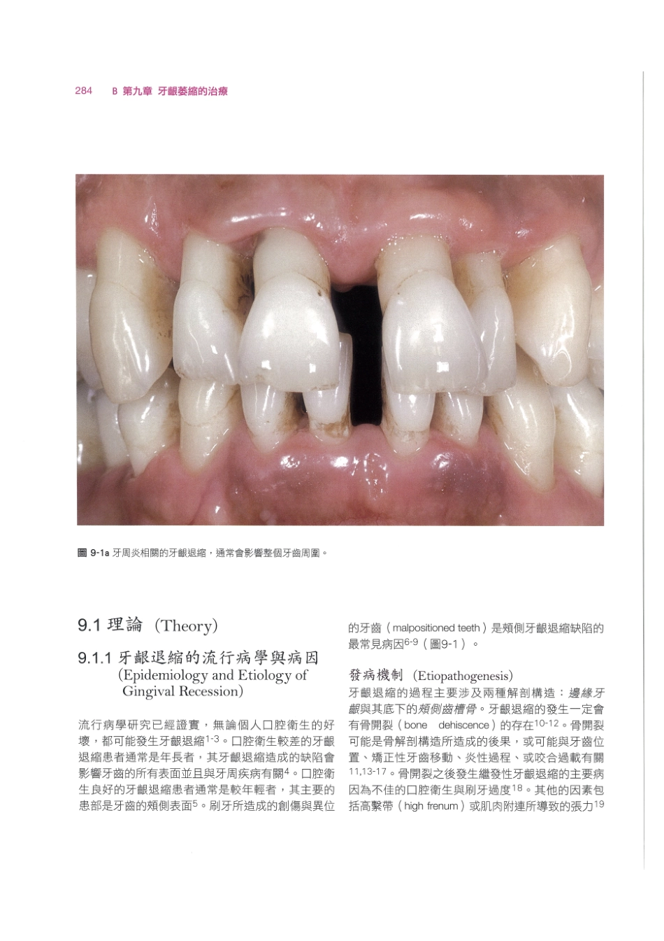 179.牙周整形美容与种植手术_297-304.pdf_第2页