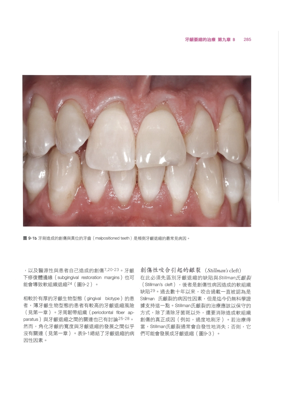 179.牙周整形美容与种植手术_297-304.pdf_第3页